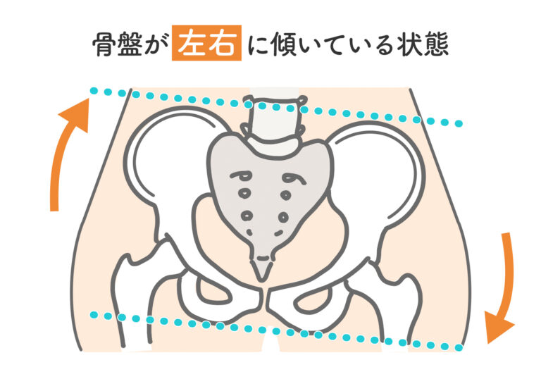 筋トレで骨盤の歪みや開きを改善！自宅で取り組める骨盤底筋トレーニング6選｜HAPPINESS! magazine(ハピネスマガジン)