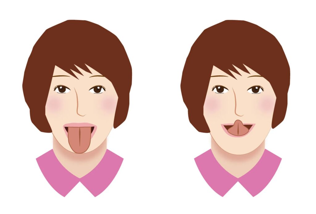 舌が喉の奥に落ち込んでしまう舌根沈下を防げる簡単舌トレーニング